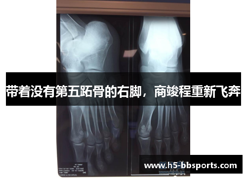 带着没有第五跖骨的右脚，商竣程重新飞奔